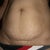 before w/ the bikini I'm hoping to wear after : )