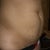  before side view