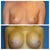 Before and after