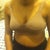 Post op Day 1 a bit bloated :/ and cant remove surgical bra until Wednesday