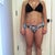 7 weeks post op