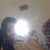 One week post op.
