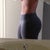 6 months post op... Love it!!