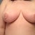 5 weeks post op
