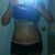 PO day 7 really sore and uneven :/