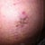 belly button at 3 weeks...yuck :(