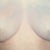 Reconstruction Dr. Berman June 2009
WIth the 'pocket protectors' & he did an amazing scar revision at the same time. 34B
