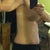 3.5 weeks post op