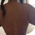 1 day post op- back view, no rolls lol