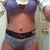 4 weeks post op