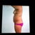 Preop side view
