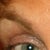 Before Latisse ...
