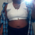 AFTER W/ SURGERY BRA
