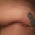 right hip almost 7wks