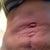 Loose skin, protruding belly button from dr stuart A. Linder