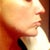 Profile before