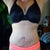 7 Weeks Post OP