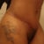 06/30/11
Scar is healing good....every week it seems like it's getting thinner and thinner.