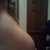 8 months - Left Side