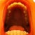 uppers with permanent retainer