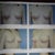 2003 Original Pre-Op Pics