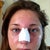 My cheeks are really swollen; Day 3