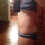 Week 2 after surgery.