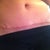 Scar. Eight inches long and straight across.