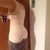 Day 4 Post Op