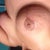 Day 19 right breast