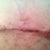 Pretty sure that's the top of my belly button ring hole