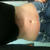 6 1/2 wks in jeans...and PS says I still have a little swelling so I guess it'll still get better.