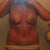 day 10 post op