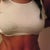 This is my wrinkly tummy.  It's still really flat even with all the swelling.  It was more wrinkle than this.  My doctor said this is a result of making the incision so small and the waist contouring that I got.  My waist is pretty small.  I love it.
