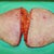5 pounds of skin removed