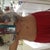 Day 2: (day after Coolsculpting) swollen!!