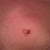 4-7-11 close up on belly button