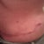 4-7-11 sideview of scar