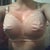 Post opp Day 3 in surgical bra
