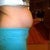 Pre-op side view