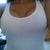 This is from post op day 28 in a tank top