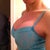 blue bralette side - 5 days po