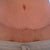 20 weeks front close view