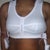 After w/ surgical bra