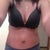 1 month 1 week after full tummy tuck