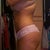 7 week post op
