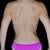 PREOP - 12/8/12