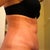 Week 5-No more bruises