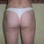 9 weeks post fat transfer