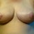 5 wks post op. Does show some dropping and maybe some fluffing. You can see in the photo the left breast is a bit bigger due to the swelling (that would be the boobie on the right as you look at the photo)